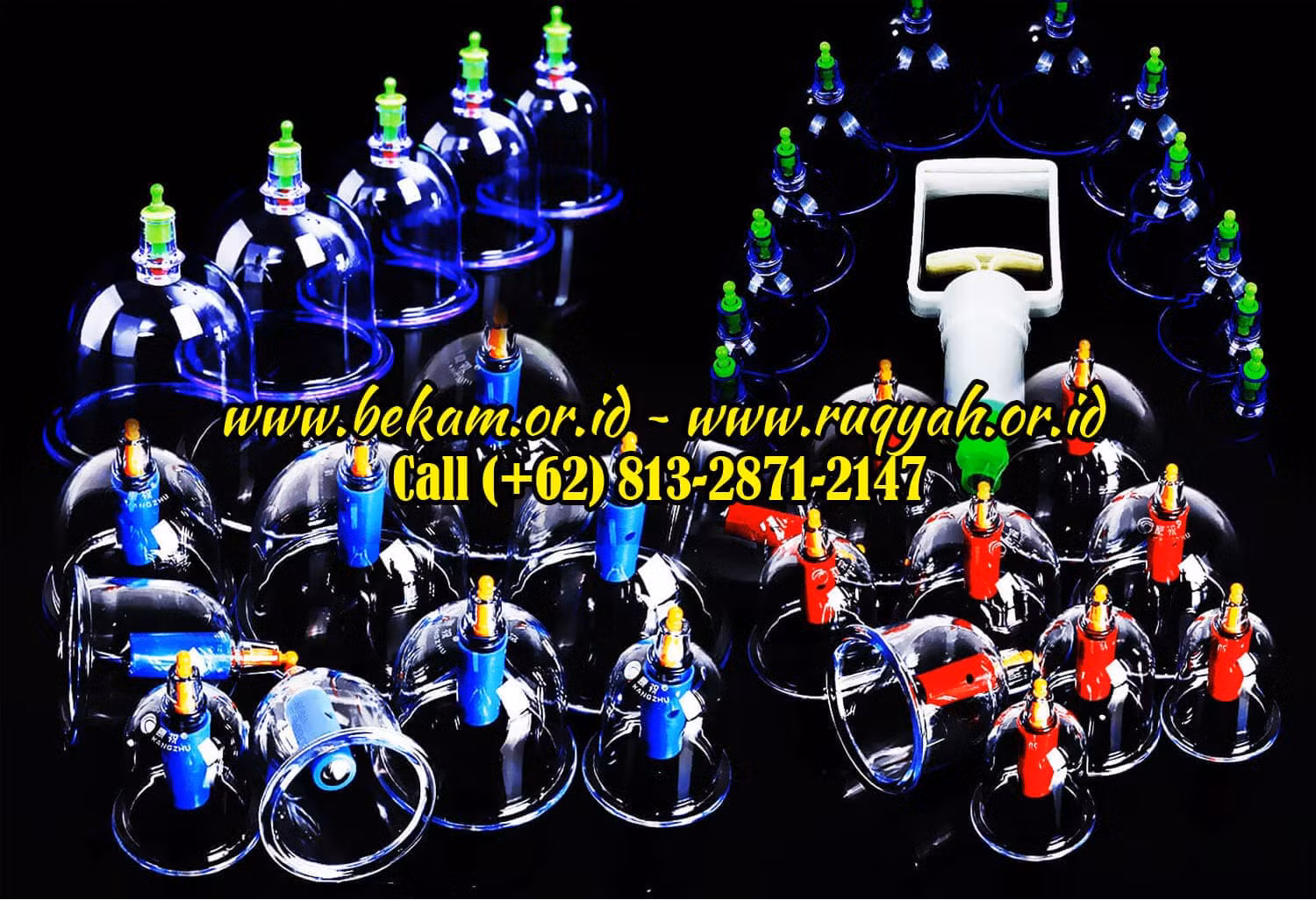 Wet Cupping Therapy Batam Releasing Oxidant from The Body